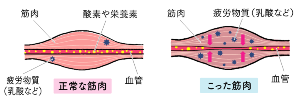 コリの原因
