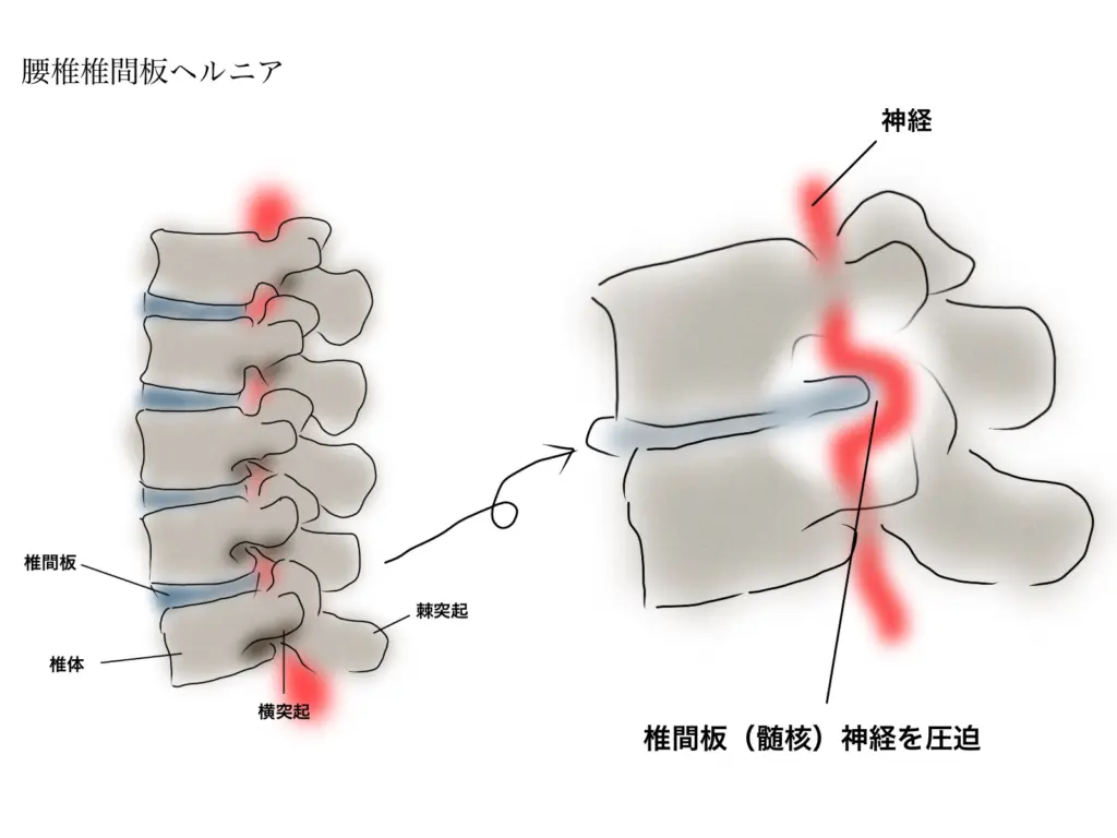22023426-1024x768.jpg.webp