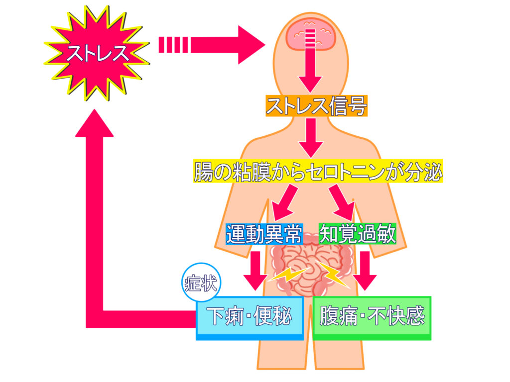 過敏性腸症候群