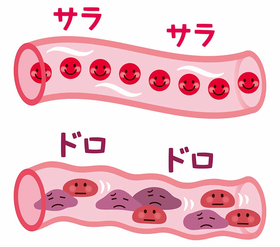 サラサラ血液とドロドロ血液